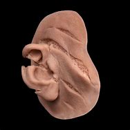 Image result for Torn Ear