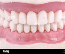 Image result for Brown Teeth Laugh