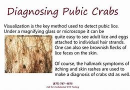 Image result for What Does Crabs Look Like On Skin