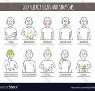 Image result for Alergy Signs