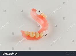 Image result for Acrylic Denture with Wrought Wire Clasps