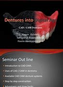 Image result for CAD/CAM Dentures