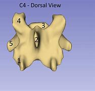 Image result for Dorsal Vertebrae