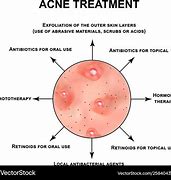 Image result for Infected Acne Pustules