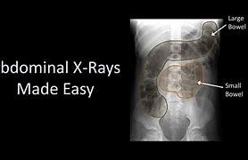 Image result for IRM Abdominal