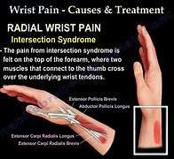 Image result for Pain in Wrist below Thumb