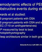 Image result for Peckidna MSM Sleep