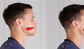 Image result for Mewing Mask