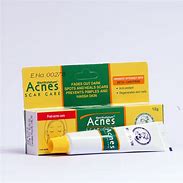 Image result for Acne Scars Home Remedy