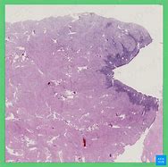 Image result for Uteres Histology