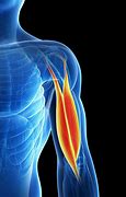 Image result for Upper Arm Pain