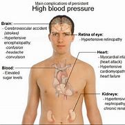 Image result for High Blood Pressure Red Face