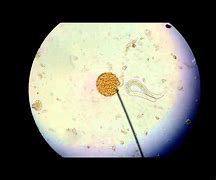 Image result for Ascaris Larvae