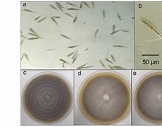 Image result for Rhizoctonia Solani Microscopic View