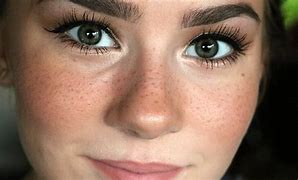 Image result for Ace Freckles