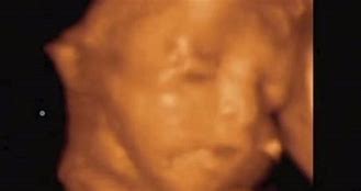 Image result for Mother 4D Baby Scan