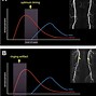 Image result for MRI Angiography