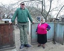 Image result for Example of Gigantism