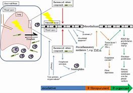 Image result for Pathophysiology of Empyema