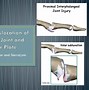 Image result for Dislocated PIP Joint in Pinky Finger