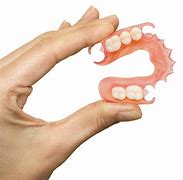 Image result for Partial Plate Dentures