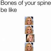 Image result for Lumbar Spine MRI Meme