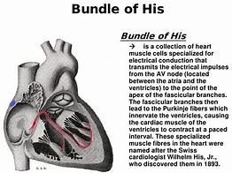 Image result for Bundle of His