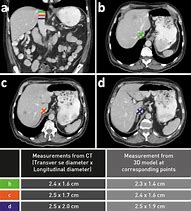 Image result for CT Scan Views