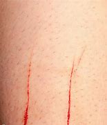 Image result for Seal Skin Cut