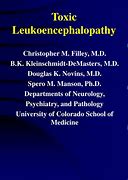 Image result for Toxic Leukoencephalopathy