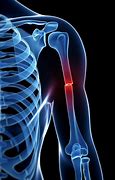 Image result for Orthophoric