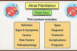 Image result for Vagal AFib Symptoms