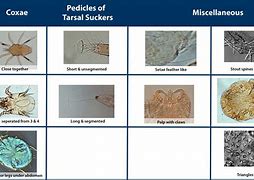 Image result for Mite Size