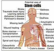 Image result for Saving Stem Cells