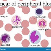 Image result for Peripheral