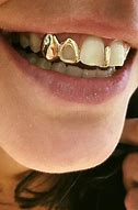 Image result for Grillz Teeth Design