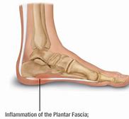 Image result for Barefoot Shoes for Plantar Fasciitis