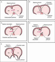 Image result for Interatrial Septum Anatomy