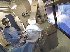 Image result for Coronary Angiography Catheters