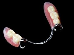 Image result for Metal-Based Partial Dentures