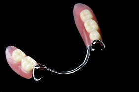 Image result for partial denture clasps materials