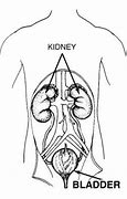 Image result for Distended Bladder