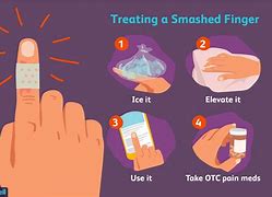 Image result for Smashed Tip of Pinky Finger