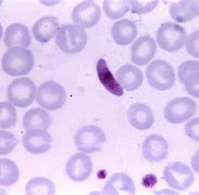 Image result for Blood Worm Parasite