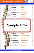 Image result for Spinal DIC Chart