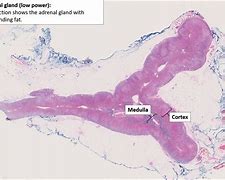 Image result for Normal Adrenal