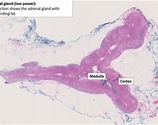 Image result for Adrenal Cortex Histology