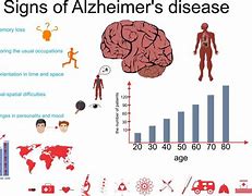 Image result for ALZ Disease