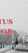 Image result for Serratus Anterior Referred Pain