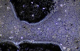 Image result for Micro Tears in Muscle Fiber Under Microscopes